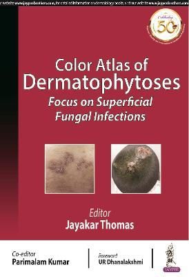 Color Atlas of Dermatophytoses By Jayakar Thomas 9789389188387
