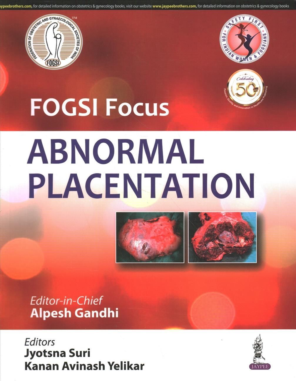 FOGSI Focus Abnormal Placentation By Alpesh Gandhi 9789389776478