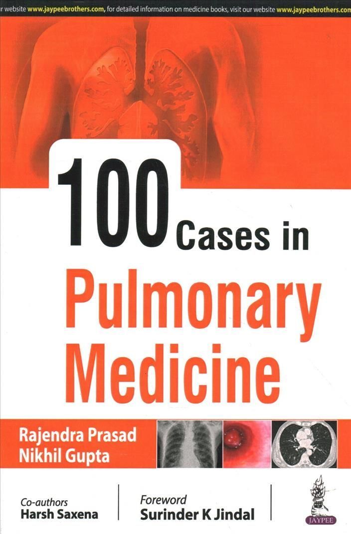 100 Cases in Pulmonary Medicine By Rajendra Prasad 9789390020096