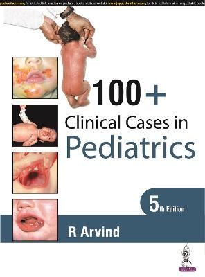 100+ Clinical Cases in Pediatrics By R Arvind 9789390595716