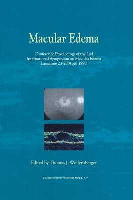 Macular Edema By Thomas J. Wolfensberger (editor) 9789401058100