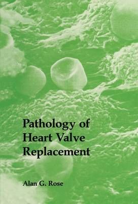 Pathology of Heart Valve Replacement By A.G. Rose 9789401079488