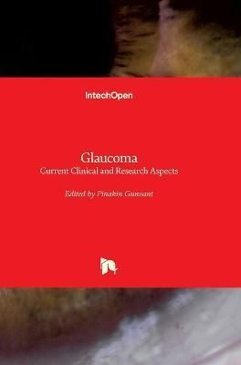 Glaucoma By Pinakin Gunvant 9789533072630 (Hardback)