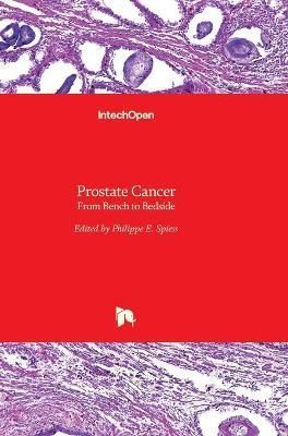 Prostate Cancer By Philippe E. Spiess 9789533073316 (Hardback)