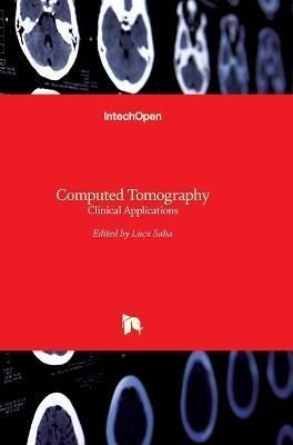 Computed Tomography By Luca Saba 9789533073781 (Hardback)