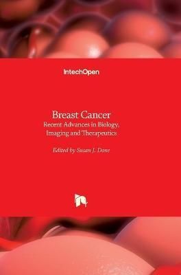 Breast Cancer By Susan J. Done 9789533077307 (Hardback)