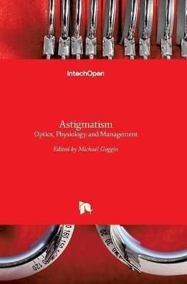 Astigmatism By Michael Goggin 9789535102304 (Hardback)