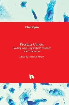 Prostate Cancer By Ravinder Mohan 9789535126447 (Hardback)