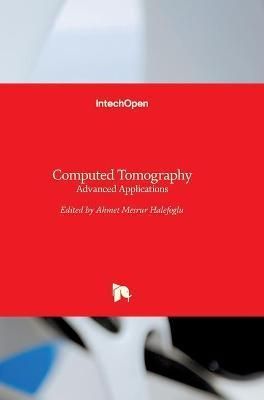Computed Tomography By Ahmet Mesrur Halefoglu 9789535133674 (Hardback)