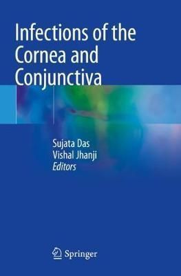 Infections of the Cornea and Conjunctiva 9789811588136 (Paperback)