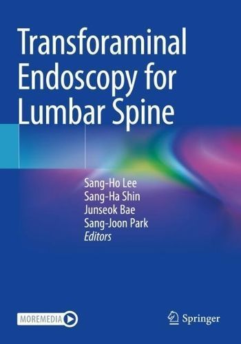 Transforaminal Endoscopy for Lumbar Spine 9789811989735 (Paperback)