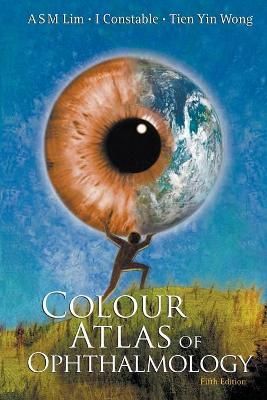 Colour Atlas of Ophthalmology (Fifth Edition) By M S Arthur Lim