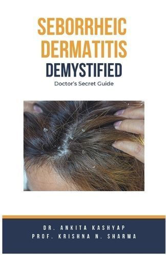 Seborrheic Dermatitis Demystified 9798223195948 (Paperback)