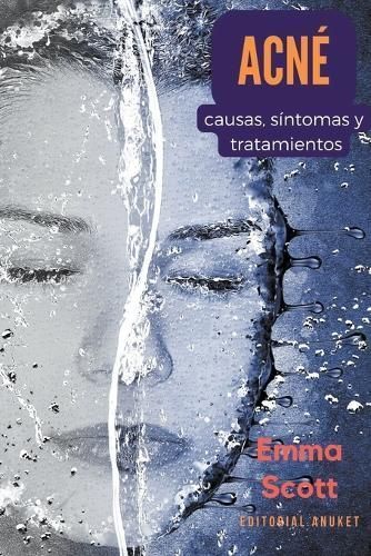 Acné By Emma Scott 9798223248774 (Paperback)