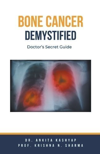 Bone Cancer Demystified By Dr Ankita Kashyap, Prof Krishna N Sharma
