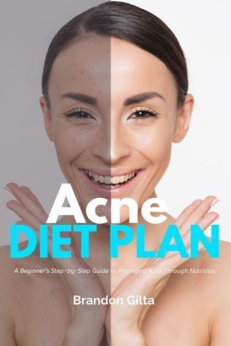 Acne Diet Plan By Brandon Gilta 9798869134127 (Paperback)