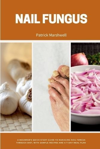 Nail Fungus By Patrick Marshwell 9798869215055 (Paperback)